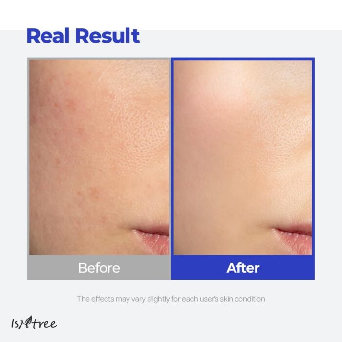 ISNTREE Hyaluronic Acid Watery Sun Gel SPF 50+ PA++++ (50mL) - Image 4