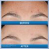 CeraVe Resurfacing Retinol Serum (30mL) - Image 3
