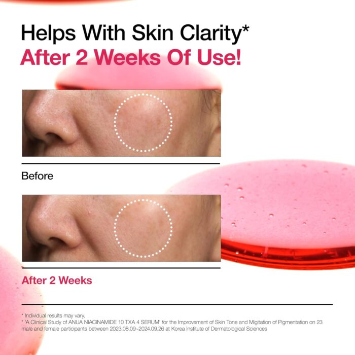 Anua Niacinamide 10% + TXA 4% Serum (30mL) - Image 6