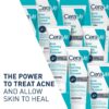 CeraVe Acne Foaming Cream Cleanser (150mL) - Image 3