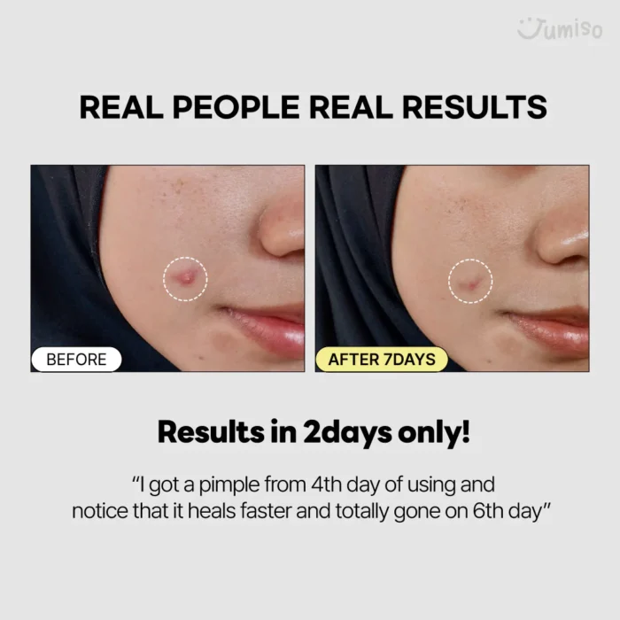 JUMISO Snail Mucin 95% + Peptide Essence Travel Size (50mL) - Image 6