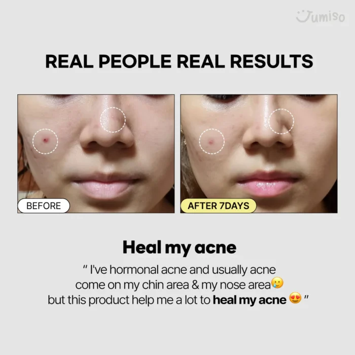 JUMISO Snail Mucin 95% + Peptide Essence Travel Size (50mL) - Image 7