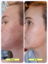 Krave Beauty Great Barrier Relief Serum (45mL) - Image 4