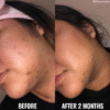Good Molecules Discoloration Correcting Serum (30mL) - Image 7