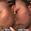 Good Molecules Discoloration Correcting Serum (30mL) - Image 8