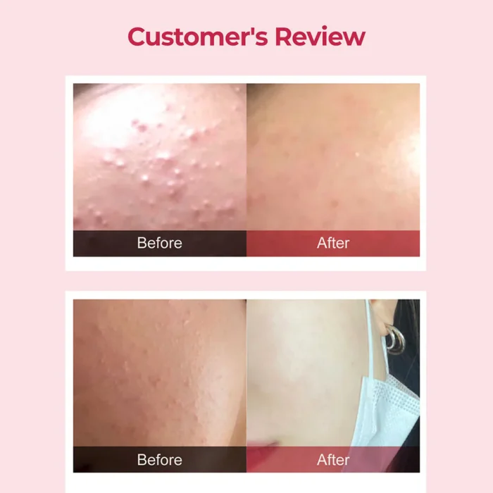 numbuzin No. 3 Skin Softening Serum (50mL) - Image 3
