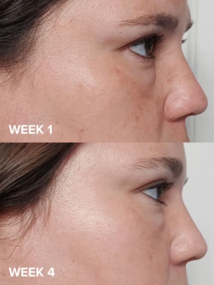 Paula’s Choice Skin Perfecting 2% BHA Liquid Exfoliant (118mL) - Image 2