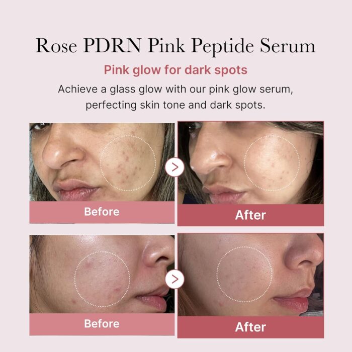 medicube PDRN Pink Peptide Serum (30mL) - Image 2