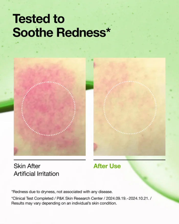 Anua Azelaic Acid 10 Hyaluron Redness Soothing Serum (30mL) - Image 5