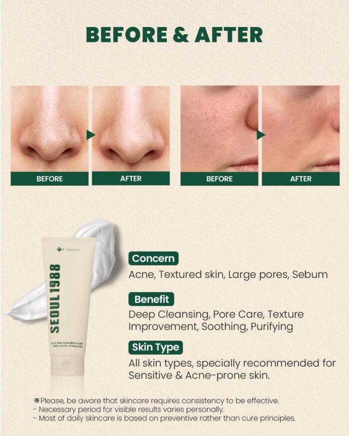 K-SECRET Seoul 1988 Cleansing Foam : Pine Cica 1% + Probiotics (150mL) - Image 3