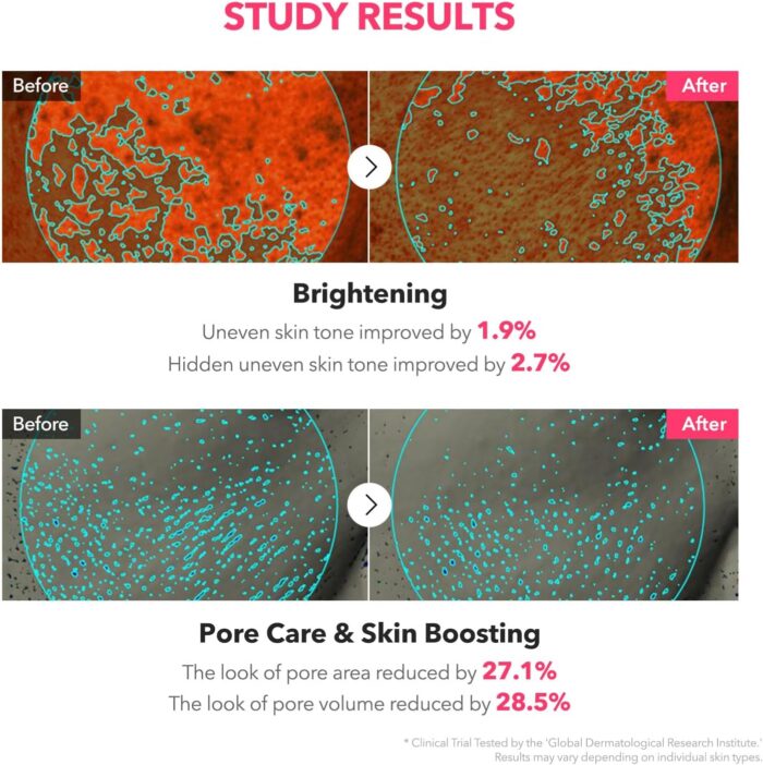 APRIL SKIN TXA Niacinamide Toning Shot 99 Serum (30mL) - Image 5