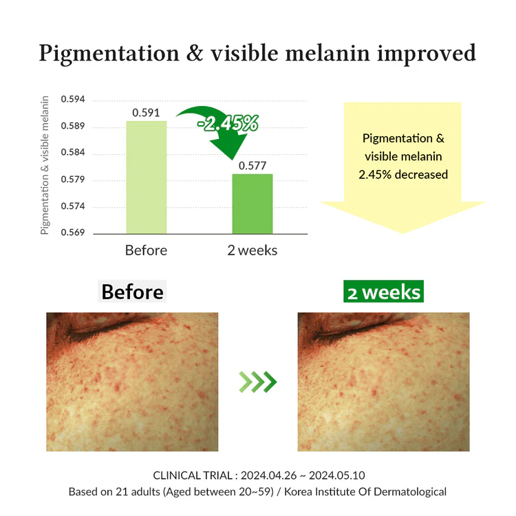 240911______-2 Dr. Althea Gentle Vitamin C Serum (30mL) - Image 6