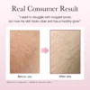 Arencia Fresh Rosehip Mochi Cleanser (120g) - Image 6
