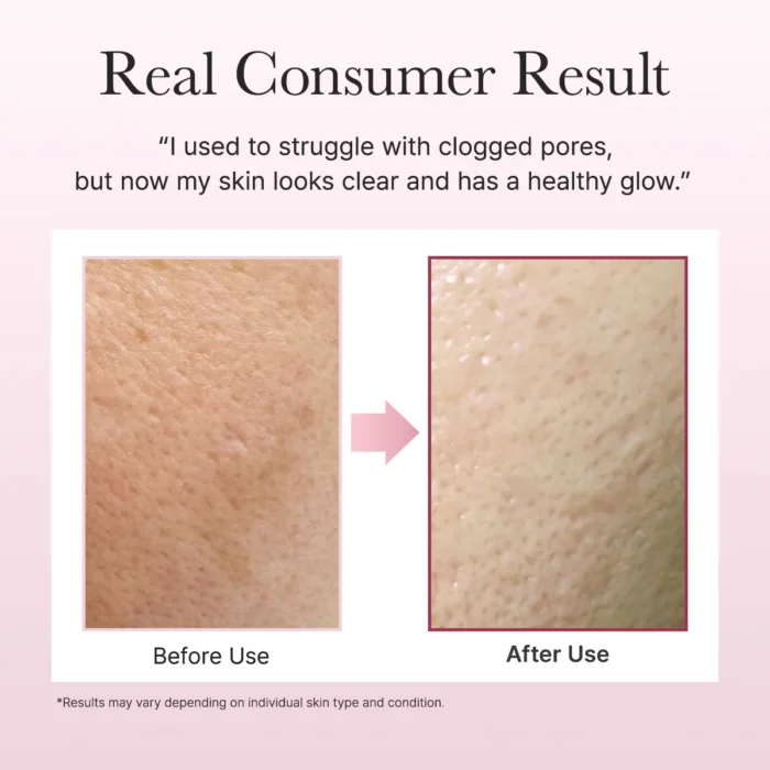Arencia Fresh Rosehip Mochi Cleanser (120g) - Image 6