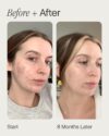 Topicals Faded Brightening + Clearing Serum Miniature (15mL) - Image 4