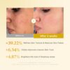 Medicube Kojic Acid Turmeric Resurfacing Toner (250mL) - Image 4