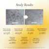 APRIL SKIN Real Calendula Peel Off Pack (100g) - Image 7