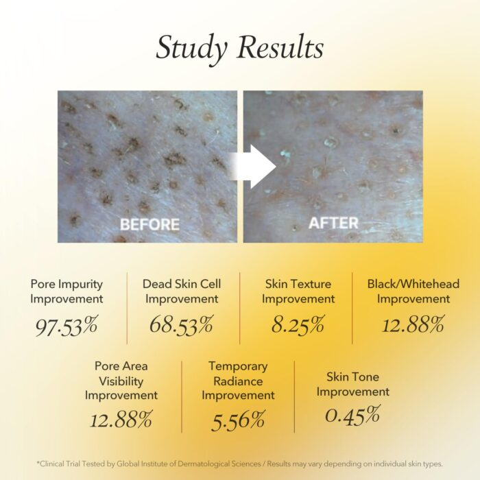 APRIL SKIN Real Calendula Peel Off Pack (100g) - Image 7