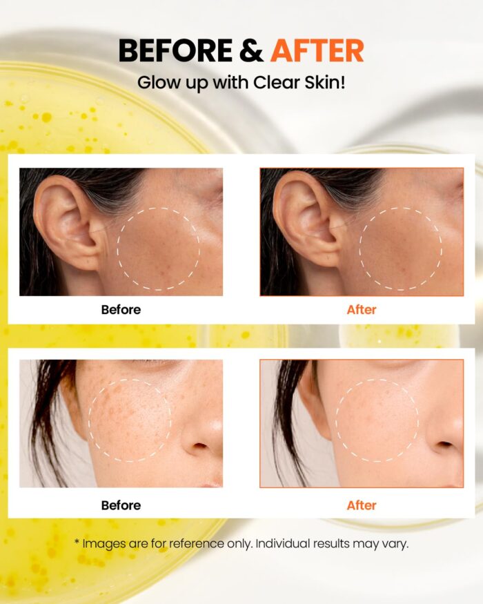 K-SECRET Seoul 1988 Glow Serum : Niacinamide 15% + Yuja (30mL) - Image 6