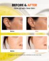 K-SECRET Seoul 1988 Glow Serum : Niacinamide 15% + Yuja (30mL) - Image 4