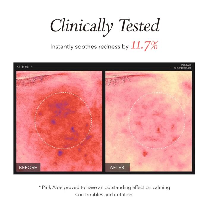APRIL SKIN Pink Aloe Pack Cleanser (120g) - Image 4