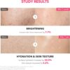 APRIL SKIN TXA Niacinamide Toning Shot 99 Milky Toner (150mL) - Image 5