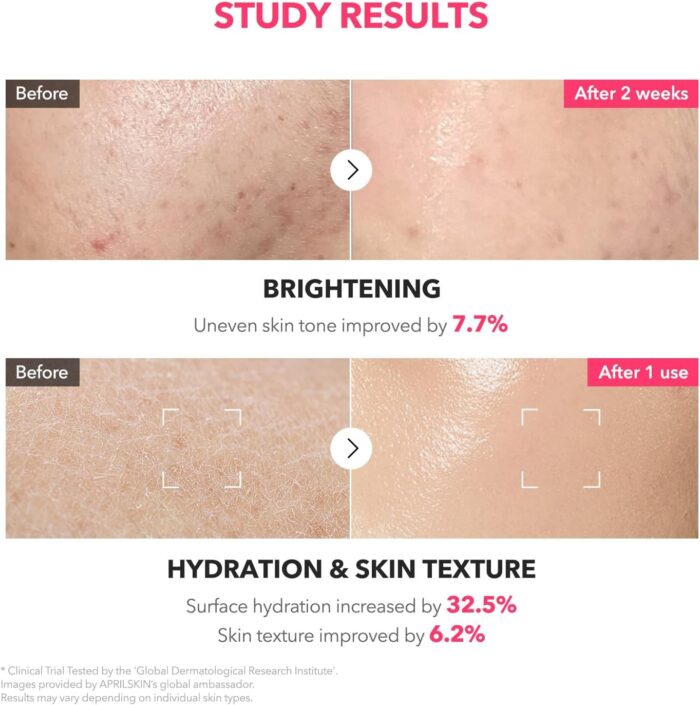 APRIL SKIN TXA Niacinamide Toning Shot 99 Milky Toner (150mL) - Image 5