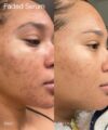 Topicals Faded Brightening + Clearing Serum (30mL) - Image 6