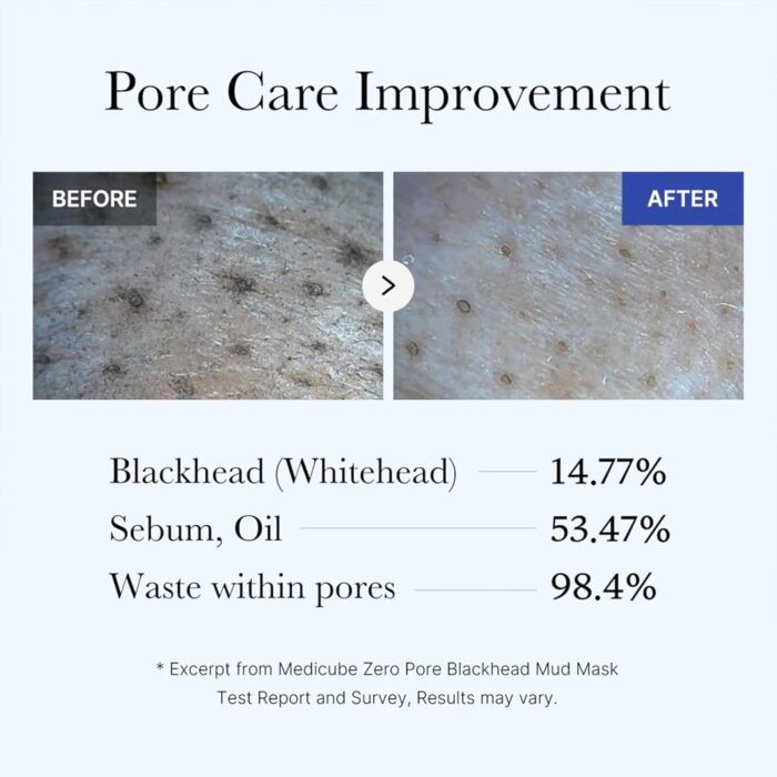 Medicube Zero Pore Blackhead Mud Mask (100g) - Image 5