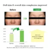 Dr. Althea Gentle Vitamin C Serum (30mL) - Image 5