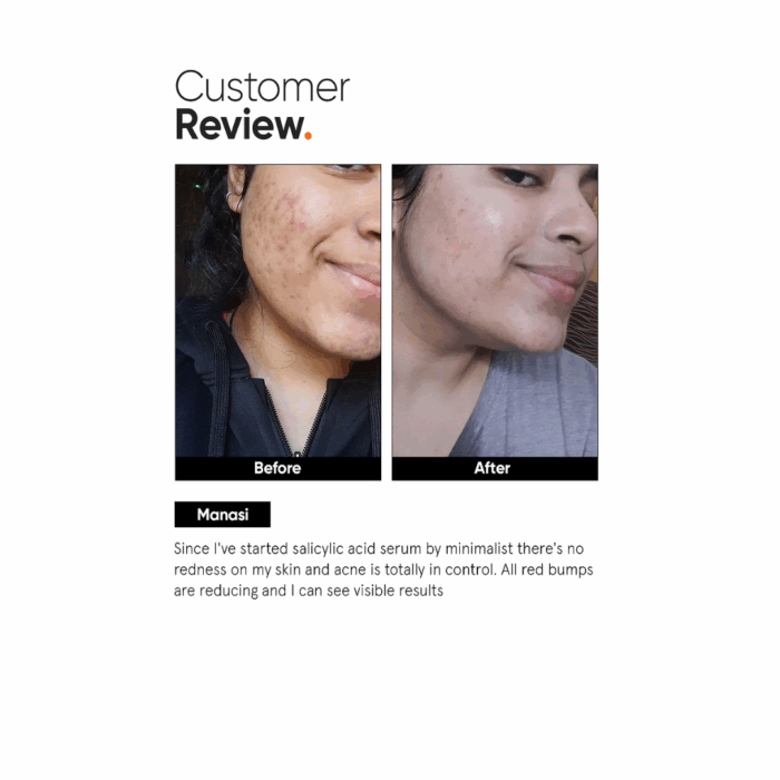 Minimalist Salicylic Acid 2% Face Serum (30mL) - Image 5
