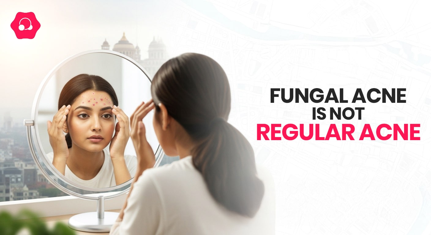 Fungal Acne Solution