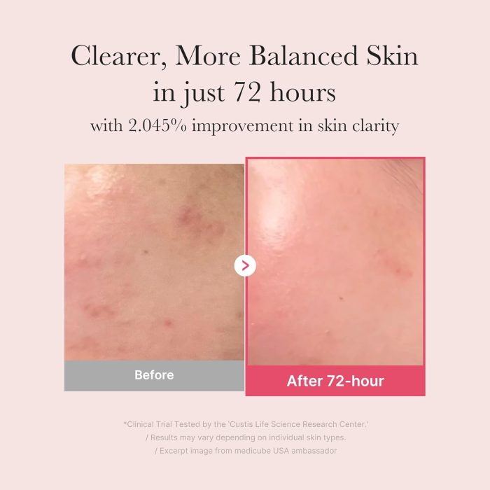 medicube TXA Niacinamide 15% Serum (30mL) - Image 3