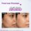 The Derma Co 10% Niacinamide Face Serum (30mL) - Image 4