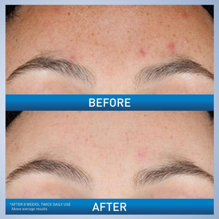 CeraVe Resurfacing Retinol Serum (30mL) - Image 3