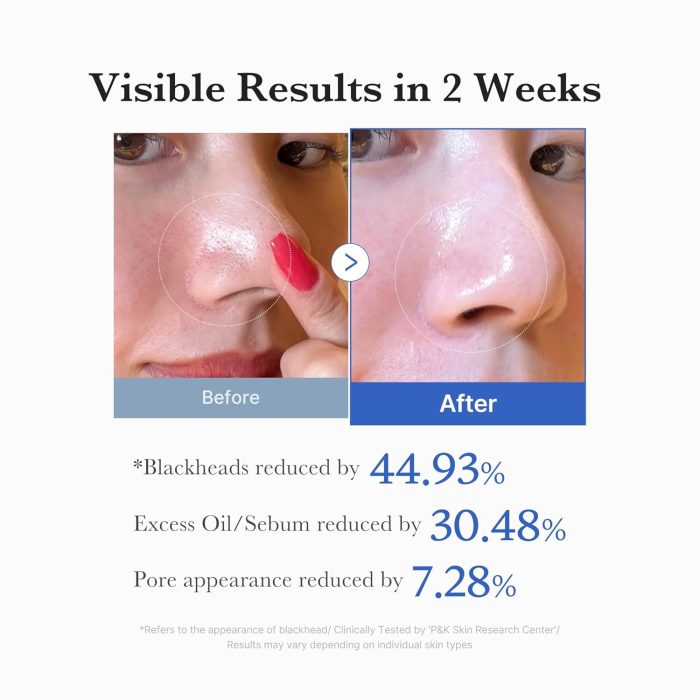 medicube Zero Pore Pad 2.0 (70 Pads) - Image 5