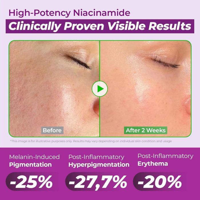 JUMISO Niacinamide 20 Serum (40mL) - Image 6
