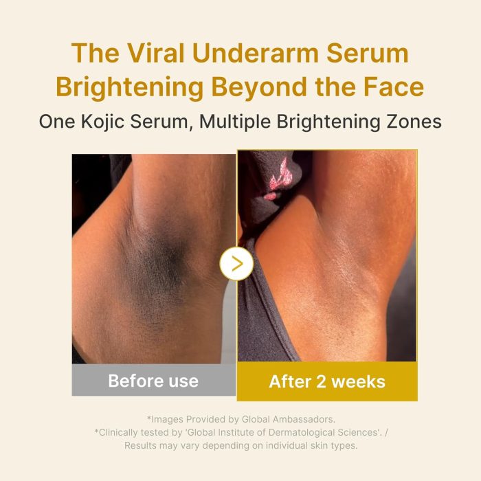Medicube Kojic Acid Turmeric Niacinamide Serum (30mL) - Image 4