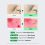 VT COSMETICS Reedle Shot 100 (50mL) - Image 6