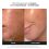 Paula's Choice Skin Perfecting 2% BHA Liquid Exfoliant Travel Size (30mL) - Image 2