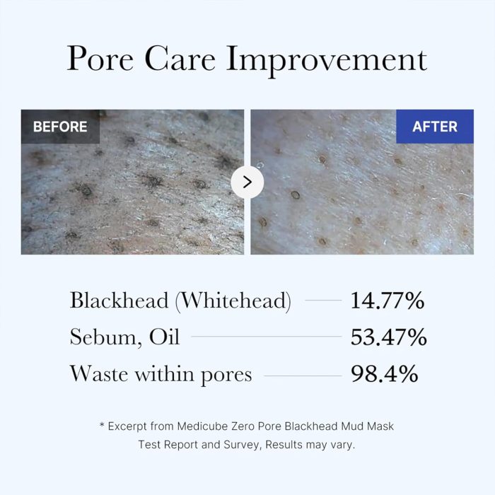 Medicube Zero Pore Blackhead Mud Mask (100g) - Image 5