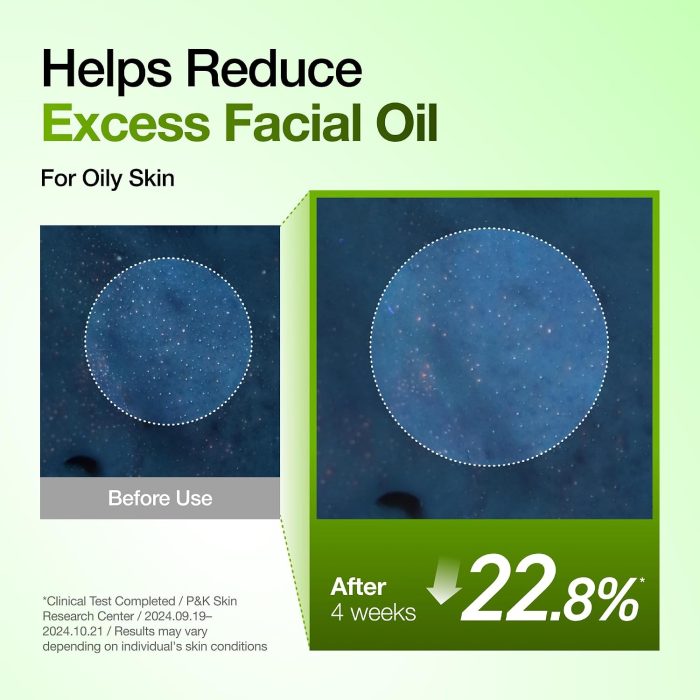Anua Azelaic Acid 10 Hyaluron Redness Soothing Serum (30mL) - Image 7