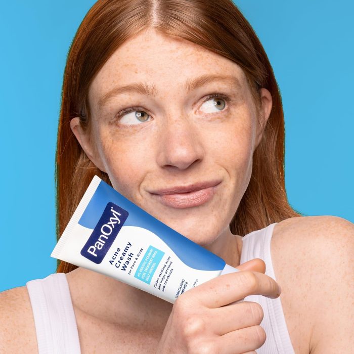 PanOxyl Acne Creamy Wash Benzoyl Peroxide 4% Daily Control (170g) - Image 5