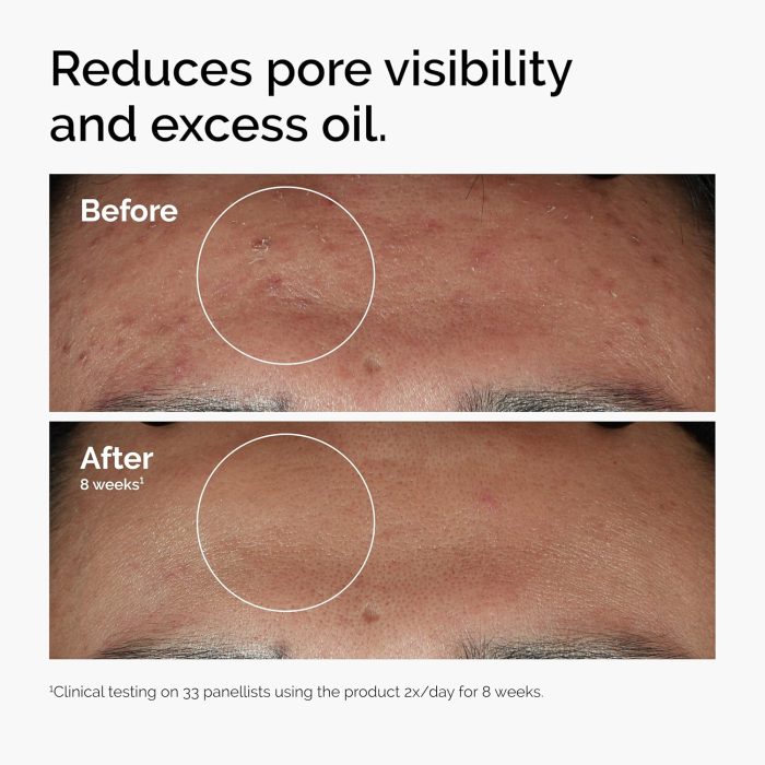 The Ordinary Niacinamide 10% + Zinc 1% Serum (30mL) - Image 2