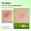 Anua Azelaic Acid 10 Hyaluron Redness Soothing Serum (30mL) - Image 5