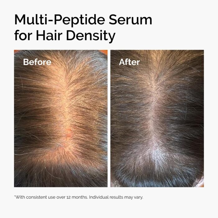 The Ordinary Multi-Peptide Serum for Hair Density (60mL) - Image 4