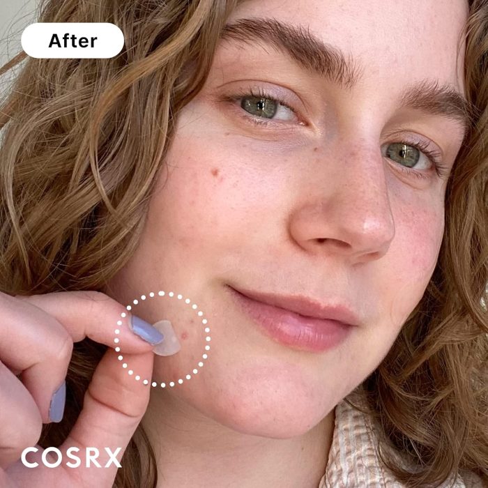 COSRX Acne Pimple Master Patch (24 Patches) - Image 2