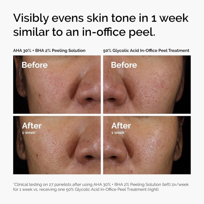 The Ordinary AHA 30% + BHA 2% Peeling Solution Serum (30mL) - Image 5